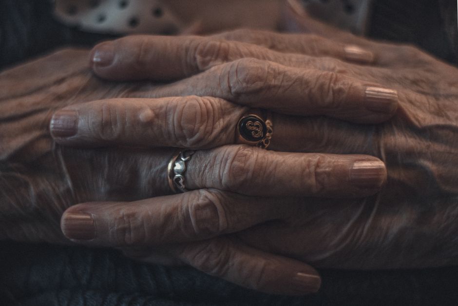 rheumatoid arthritis joint pain pain management